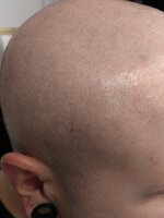 balding clippers sallys